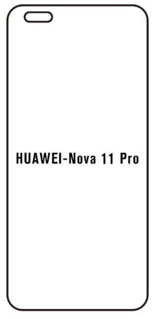 Hydrogel - ochranná fólie - Huawei Nova 11 Pro (case friendly)