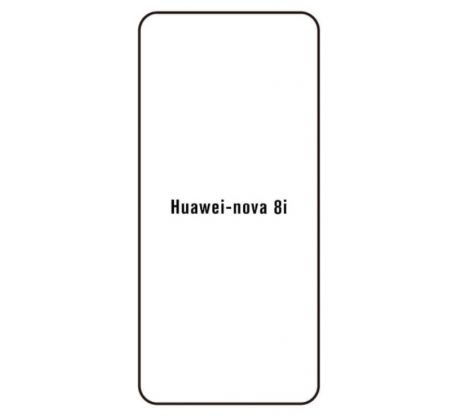 Hydrogel - ochranná fólie - Huawei Nova 8i, typ výřezu 2