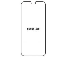 Hydrogel - matná ochranná fólie - Huawei Honor X8b