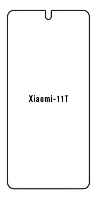 Hydrogel - ochranná fólie - Xiaomi 11T