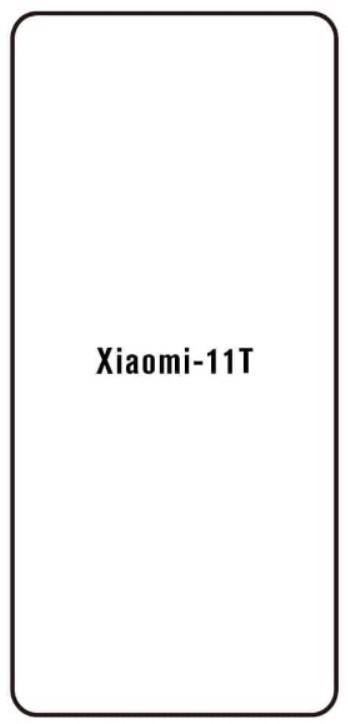 Hydrogel - ochranná fólie - Xiaomi 11T, typ výřezu 2