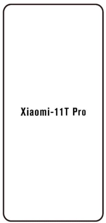 Hydrogel - ochranná fólie - Xiaomi 11T Pro, typ výřezu 2