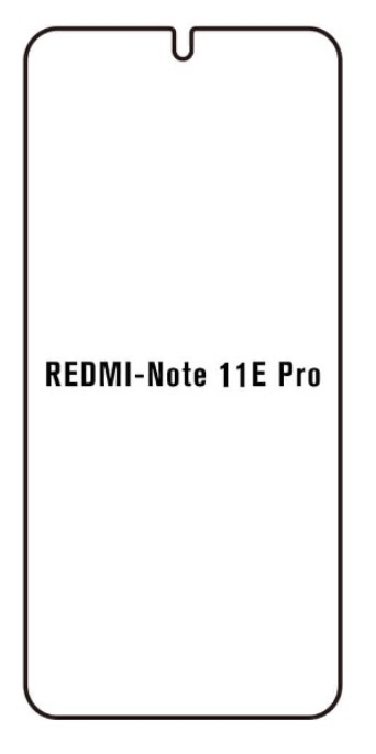 Hydrogel - ochranná fólie - Xiaomi Redmi Note 11E Pro 5G (case friendly)