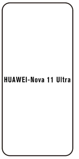 Hydrogel - ochranná fólie - Huawei Nova 11 Ultra