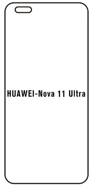 Hydrogel - ochranná fólie - Huawei Nova 11 Ultra (case friendly)