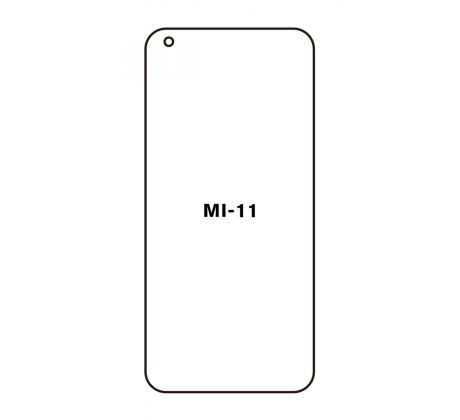Hydrogel - matná ochranná fólie - Xiaomi Mi 11 