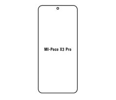 Hydrogel - matná ochranná fólie - Xiaomi Poco X3 Pro