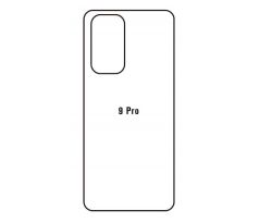Hydrogel - zadní ochranná fólie - OnePlus 9