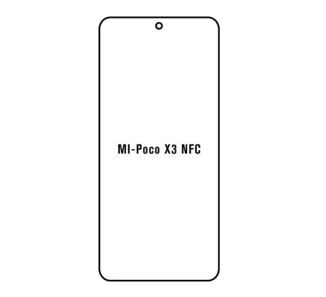 Hydrogel - Privacy Anti-Spy ochranná fólie - Xiaomi Poco X3 NFC