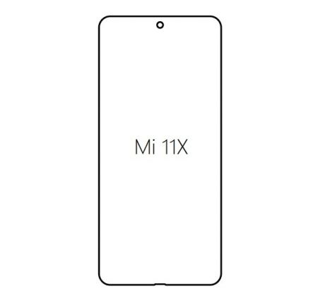 Hydrogel - Privacy Anti-Spy ochranná fólie - Xiaomi Mi 11X