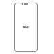 Hydrogel - Privacy Anti-Spy ochranná fólie - Xiaomi Mi A2