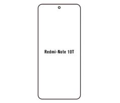 Hydrogel  Privacy Anti-Spy ochranná fólie - Xiaomi Redmi Note 10T 4G