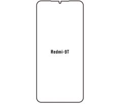 Hydrogel - ochranná fólie - Xiaomi Redmi 9T, typ výřezu 2