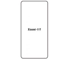Hydrogel - ochranná fólie - Xiaomi 11T (varianta 2)