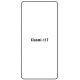 Hydrogel - ochranná fólie - Xiaomi 11T, typ výřezu 2