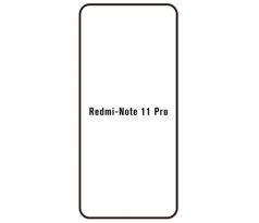 Hydrogel - ochranná fólie - Xiaomi Redmi Note 11 Pro/11 Pro 5G, typ výřezu 2