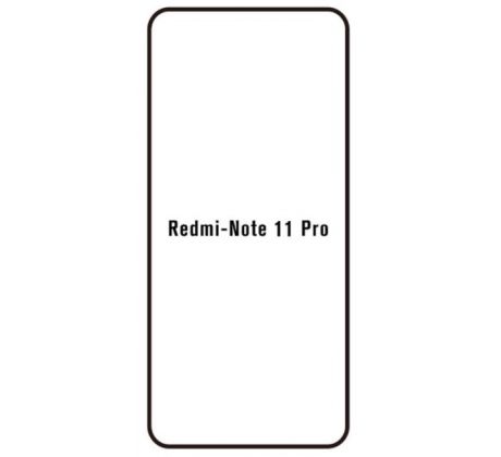 Hydrogel - ochranná fólie - Xiaomi Redmi Note 11 Pro/11 Pro 5G, typ výřezu 2