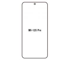 Hydrogel - Privacy Anti-Spy ochranná fólie - Xiaomi 12S Pro