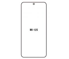 Hydrogel - Privacy Anti-Spy ochranná fólie - Xiaomi 12S