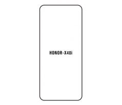 Hydrogel - ochranná fólie - Huawei Honor X40i