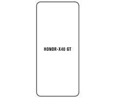 Hydrogel - ochranná fólie - Huawei Honor X40 GT