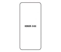 Hydrogel - ochranná fólie - Huawei Honor X40i (case friendly)