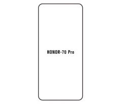 Hydrogel - ochranná fólie - Huawei Honor 70 Pro (case friendly)