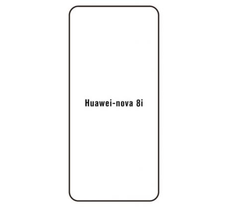 Hydrogel - ochranná fólie - Huawei Nova 8i (case friendly)