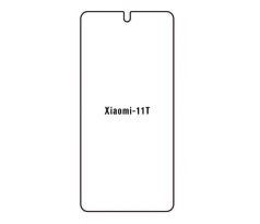 Hydrogel - ochranná fólie - Xiaomi 11T (case friendly)
