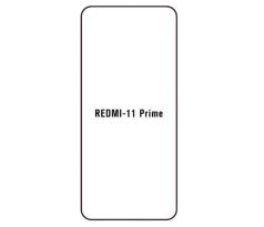 Hydrogel - ochranná fólie - Xiaomi Redmi 11 Prime 5G (case friendly)