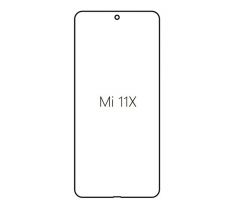 Hydrogel - ochranná fólie - Xiaomi Mi 11X (case friendly)