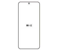 Hydrogel - ochranná fólie - Xiaomi 12/ Xiaomi 12X (case friendly)