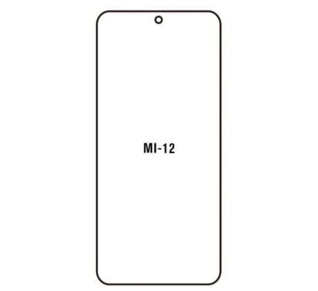Hydrogel - ochranná fólie - Xiaomi 12/ Xiaomi 12X (case friendly)