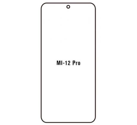 Hydrogel - ochranná fólie - Xiaomi 12 Pro (case friendly)