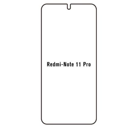 Hydrogel - ochranná fólie - Xiaomi Redmi Note 11 Pro/11 Pro 5G (case friendly)