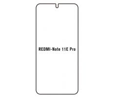 Hydrogel - ochranná fólie - Xiaomi Redmi Note 11E Pro 5G (case friendly)