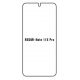 Hydrogel - ochranná fólie - Xiaomi Redmi Note 11E Pro 5G (case friendly)