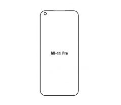 Hydrogel - ochranná fólie - Xiaomi Mi 11 Pro (case friendly)