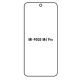 Hydrogel - ochranná fólie - Xiaomi Poco M4 Pro 5G (case friendly)