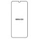 Hydrogel - ochranná fólie - Nokia G20 (case friendly)