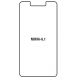 Hydrogel - ochranná fólie - Nokia 6.1 2018 (case friendly)