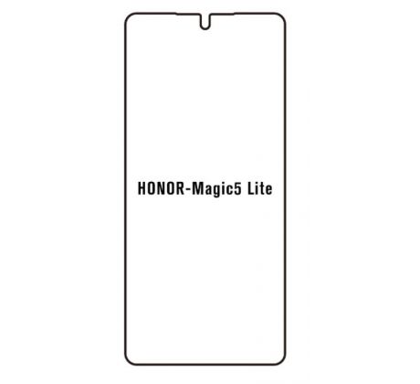 Hydrogel - ochranná fólie - Huawei Honor Magic 5 lite (case friendly) 