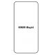 Hydrogel - ochranná fólie - Huawei Honor Magic5 