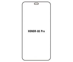 UV Hydrogel s UV lampou - ochranná fólie - Huawei Honor 80 Pro  