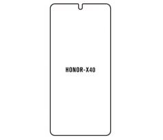 UV Hydrogel s UV lampou - ochranná fólie - Huawei Honor X40