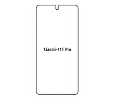 UV Hydrogel s UV lampou - ochranná fólie - Xiaomi 11T Pro