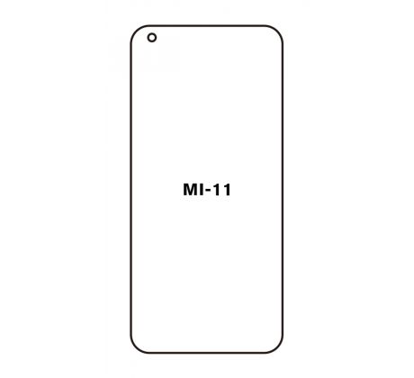 UV Hydrogel s UV lampou - ochranná fólie - Xiaomi Mi 11 