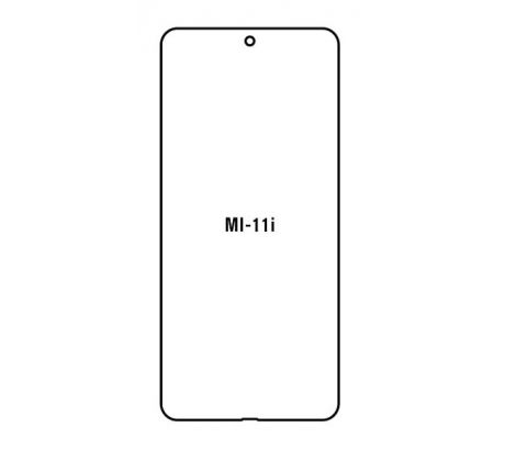 UV Hydrogel s UV lampou - ochranná fólie - Xiaomi Mi 11i 