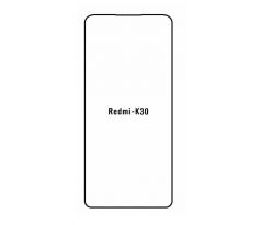 UV Hydrogel s UV lampou - ochranná fólie - Xiaomi Redmi K30 Ultra 