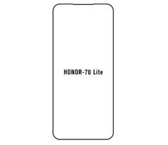 Hydrogel - ochranná fólie - Huawei Honor 70 lite